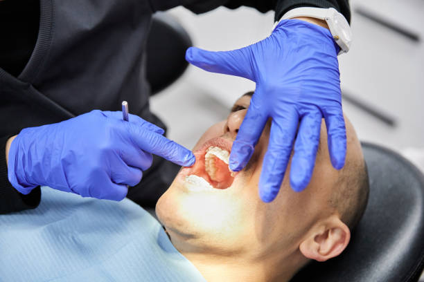 Best After-Hours Dental Trauma Care in Ramblewood, NJ